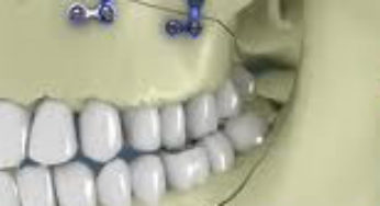 Família de Douglas faz apelo por cirurgia buco-maxilo facial