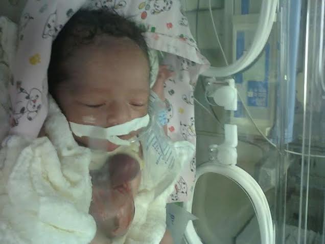 Ministério da Saúde autoriza tratamento de Alejandro; criança com doença rara que está na UTI da Maternidade Barbara Heliodora