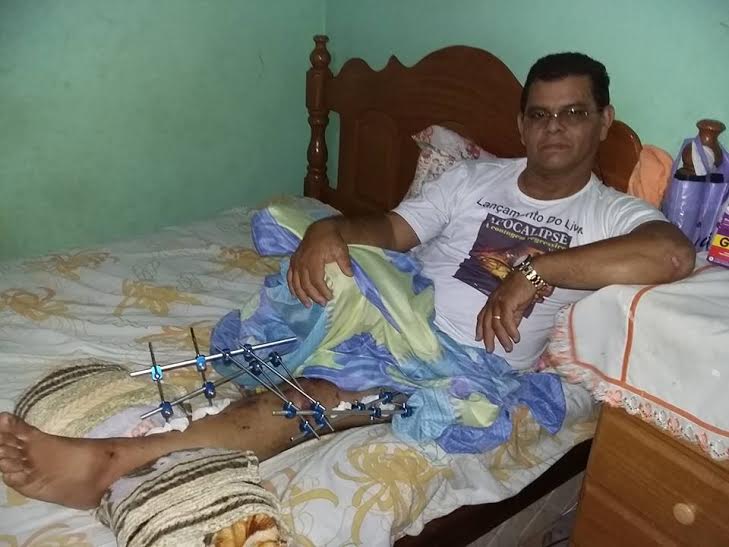 Pastor espera há 40 dias por uma cirurgia na perna