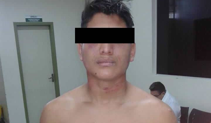 ​Jovem de 17 anos diz ter sido violentado por policiais em ramal de Rio Branco