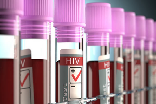 Cientistas dizem ter suprimido vírus HIV do organismo de cinco pessoas