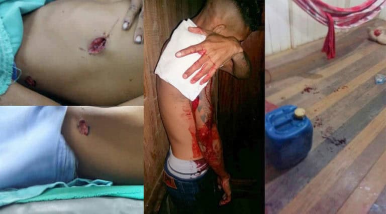Tarauacá registra duas tentativas de homicídio em menos de 12 horas