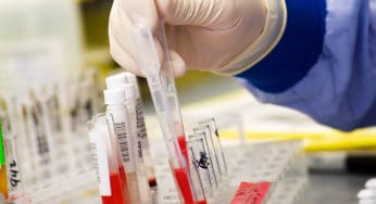 Mal de Alzheimer pode ser detectado 20 anos antes dos sintomas em exame de sangue