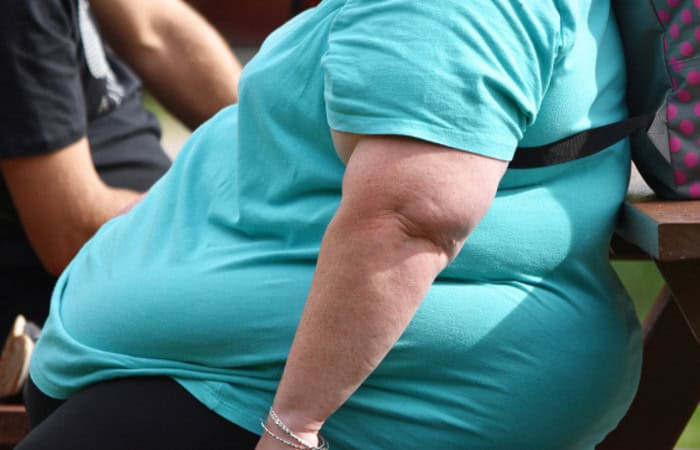 Saúde prepara ações para controle do excesso de peso