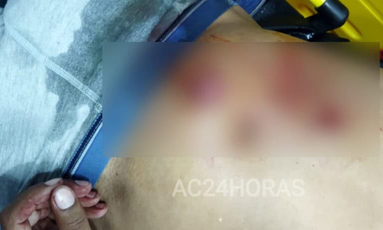 Padrasto é ferido com golpes de faca e fica com intestino exposto em Rio Branco