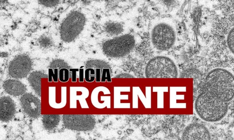 Dois casos suspeitos de varíola dos macacos são registrados em Cruzeiro do Sul