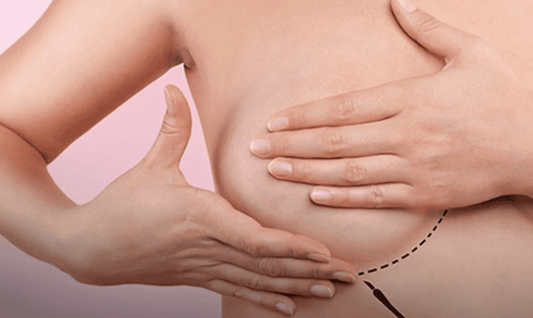 Acre tem entre 110 a 130 novos casos de câncer de mama por ano, diz estudo