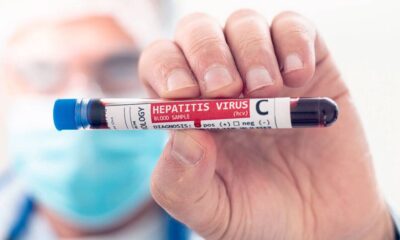 Boletim mostra redução de 87% das mortes por hepatite C e 54,5% na hepatite B