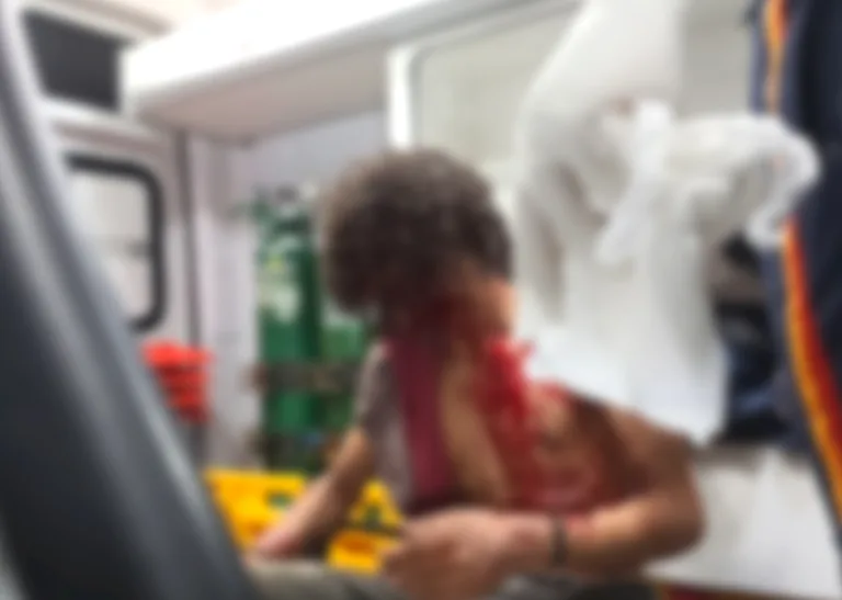 Jovem é agredido a garrafadas e ripadas por desconhecido na rua, em Rio Branco
