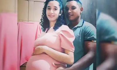 Gêmeas siamesas de acreana que compartilham coração nascem em Brasília