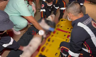 Colisão entre motocicletas deixa condutores gravemente feridos na Sobral