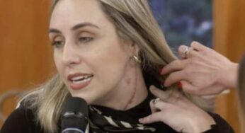 Mulher choca Patrícia Poeta ao exibir cicatrizes após levar 20 facadas do ex