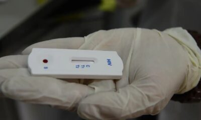 Saúde orienta farmácias sobre testes para HIV, sífilis e hepatites