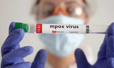 Brasil supera marca de mil casos de mpox em 2024