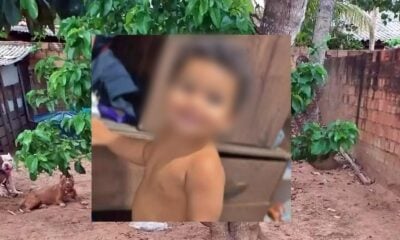 Bebê de 1 ano morre ao ser atacado por pitbull em Rondônia