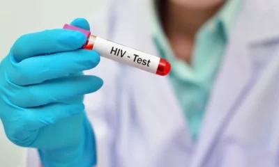 Acre tem aumento nos casos de HIV com 244 novos registros