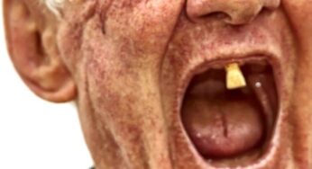 “Quem não cuida dos dentes não está preparado para votar”