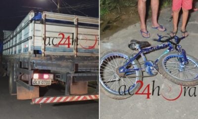 Criança fica em estado grave ao colidir bicicleta em caminhão na Sobral