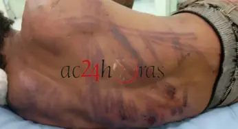 Homem é açoitado com fio por membros de organização criminosa