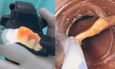 No Acre, homem vai parar no hospital após engolir a própria dentadura