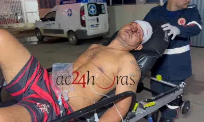 Discussão em bar termina em agressão brutal com taco de sinuca
