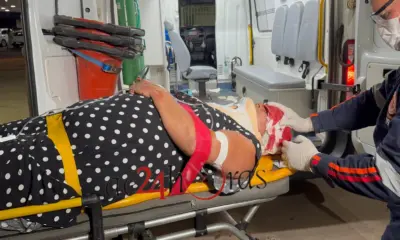 Motociclista fica em estado grave após colidir com carro na BR-317