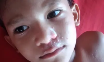 Família de criança com autismo e doença autoimune sobrevive com R$ 700 em Cruzeiro do Sul