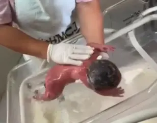 Suspeita de causar queimaduras em bebê é ouvida nesta sexta-feira polícia