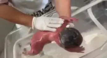 Suspeita de causar queimaduras em bebê é ouvida nesta sexta-feira polícia
