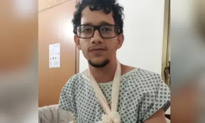 Jovem fica ferido após bolo explodir durante festa de aniversário em Palmas