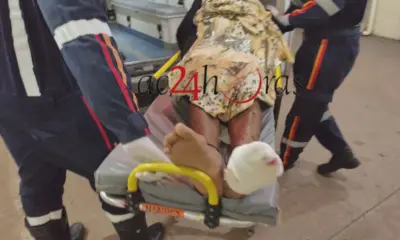 Colisão entre carro e moto deixa homem com dedo amputado