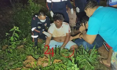 Motociclista cai e fica ferido após passar por buraco em Rio Branco