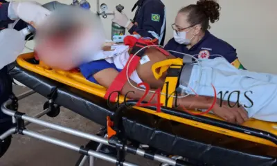 Adolescente sofre lesão grave na cabeça ao colidir bicicleta motorizada com ônibus