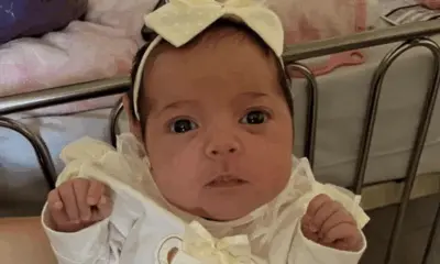 Bebê que sofreu queimaduras recebe alta hospitalar