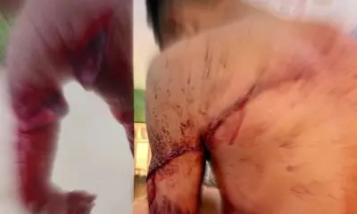 Acusado de agredir a esposa leva terçadada do cunhado e é socorrido ao hospital