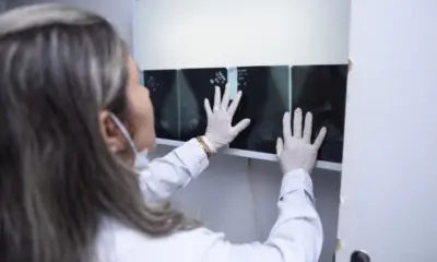 Mais de 500 mulheres deixaram de buscar resultado da mamografia no Cecon