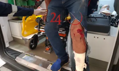 Colisão entre moto e carro deixa duas pessoas feridas no bairro Aviário, em Rio Branco
