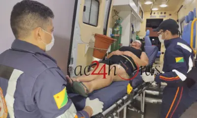 Mulher sofre ferimento grave na testa após marido golpear cabeça em quina de parede