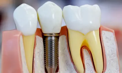 Instituto é responsabilizado pela morte de paciente voluntário em implante dentário