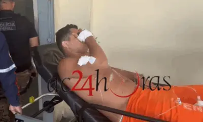 Confronto no banho de sol deixa três presos feridos no Quinari