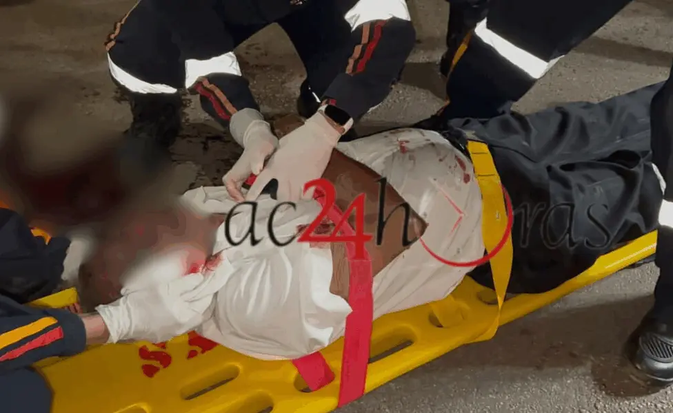Idoso fica em estado grave ao ser atingido por moto em Rio Branco