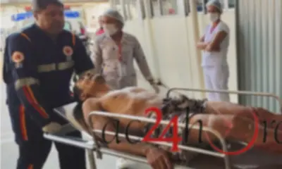 Homem é agredido a golpes de ripa e perna-manca  na Baixada da Sobral