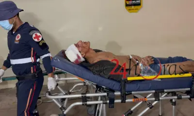 Dupla espanca homem e deixa vítima com fratura exposta no Preventório, em Rio Branco