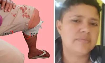 Mulher não aceita fim de relacionamento e esfaqueia companheira