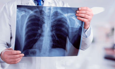 Estudo aponta que Acre está entre os estados com menor acesso à radiologia no Brasil