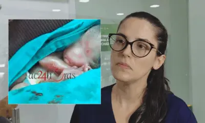 “É uma situação excepcional, pode acontecer”, afirma neonatologista sobre bebê prematuro