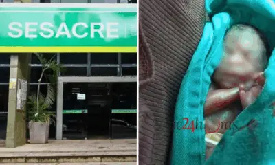 Sesacre diz que protocolos de reanimação em bebê foram rigorosamente seguidos