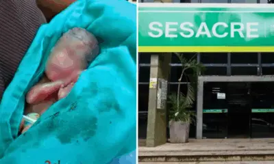 Sesacre informa que bebê prematuro segue em estado grave, porém estável