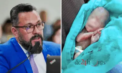 Alan Rick garante vaga na UTI Neonatal de São Paulo para bebê que sobreviveu após ser dado como morto