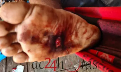 Criminosos se passam por policiais e atacam família indígena em Brasileia